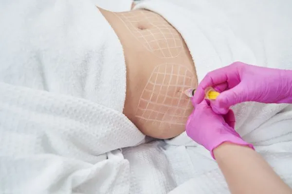 image of fat dissolving injections on love handles to help combat weight gain Kirkcaldy