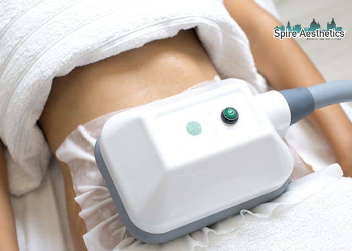 Shift Those Extra Pounds: How Fat Freezing Can Help You Slim Down Kirkcaldy
